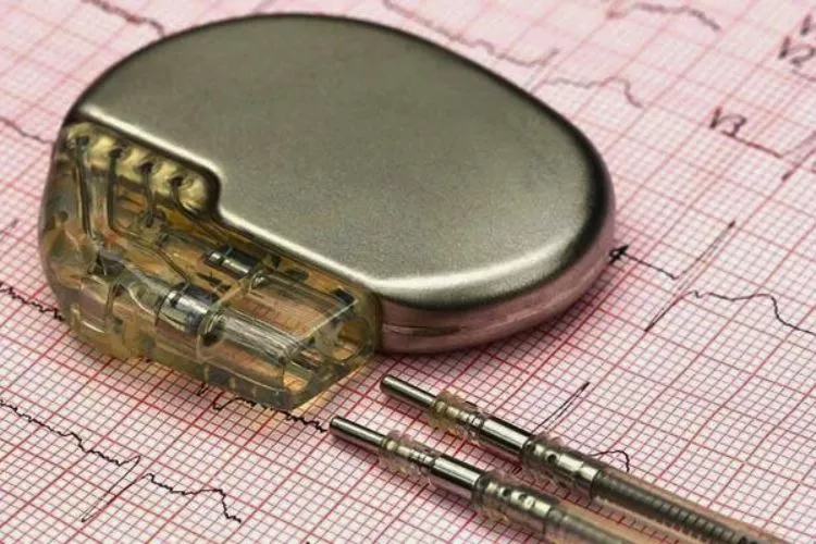 What Are Pacemakers